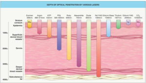 Is one form of non-ablative laser better than the other?